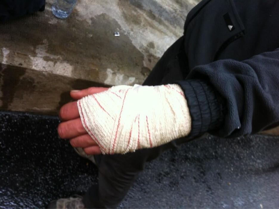 Una persona con un brazo vendado tras la actuación policial. (@erreharria)