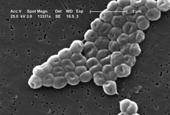La bacteria Acinetobacter baumannii. (Wikipedia)