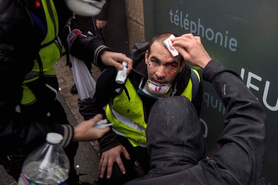 Un manifestante es atendido en Nantes tras sufrir una herida. (SEBASTIEN SALOM-GOMIS / AFP)