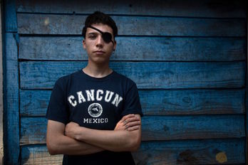 El estudiante chileno Carlos Vivanco de 18 años resultó herido en un ojo el 11 de noviembre. (Claudio REYES/AFP)