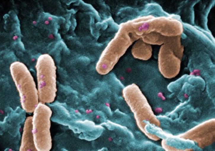 Un equipo de Ikerbasque ha conseguido dar con la estructura de la toxina de una bacteria muy peligrosa para las personas con enfermedades pulmonares. (IKERBASQUE)