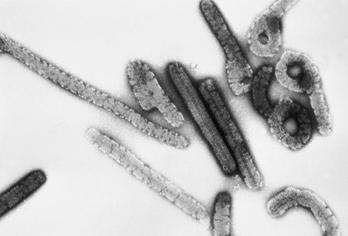 Virus de Marburgo, multiplicado por 100.000 al microscopio. (Wikimedia)