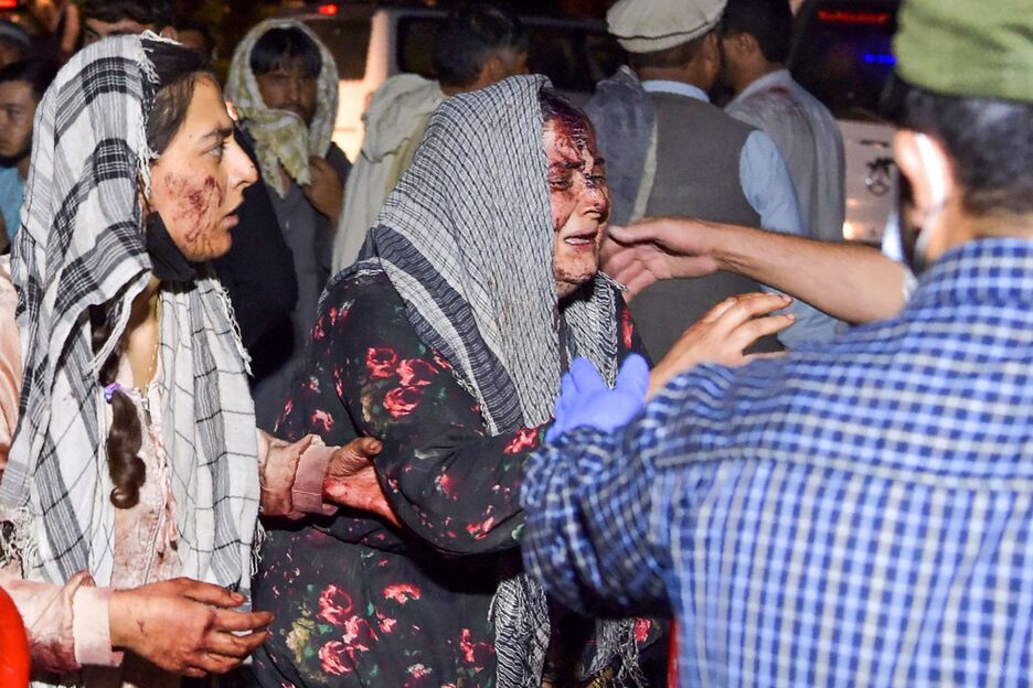 Mujeres heridas llegan a un hospital para recibir tratamiento después de dos explosiones. (Wakil KOHSAR/AFP)
