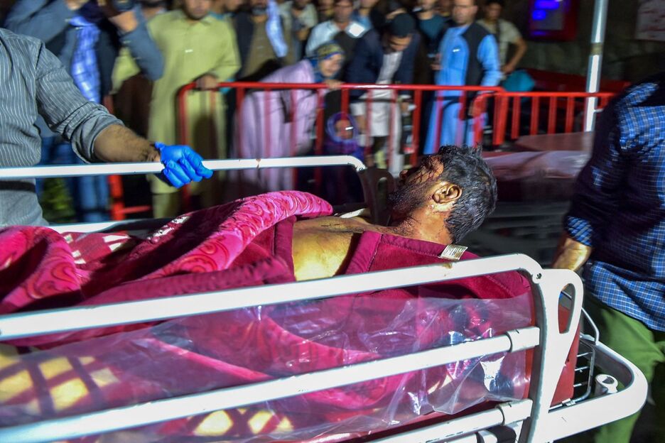 El personal médico traslada a un hombre herido en una camilla. (Wakil KOHSAR/AFP) 