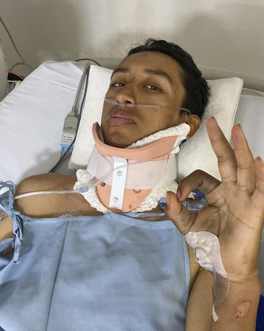 Imagen que el propio Egan Bernal colgó en su cuenta de Instagram tras el accidente.