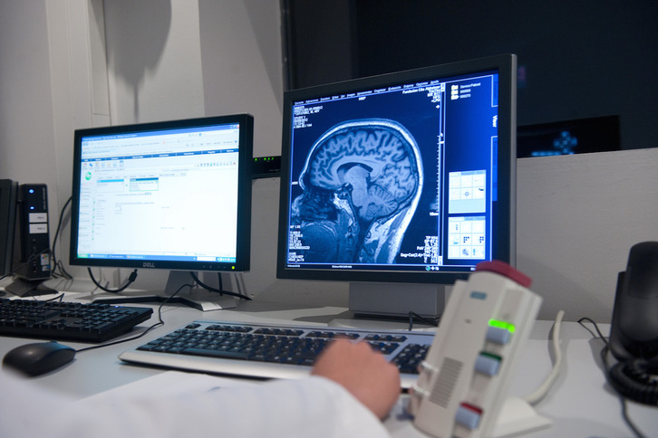 Los expertos del BCBL utilizaron la resonancia magnética de alta precisión para examinar las respuestas cerebrales de siete participantes.
