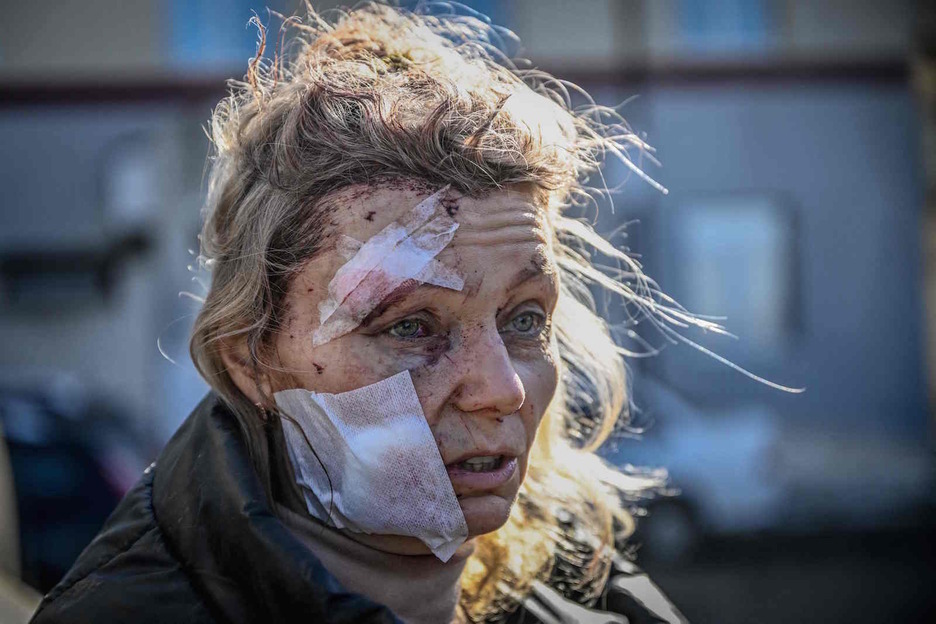 Una mujer herida, a las puertas de un hospital tras el ataque sobre la ciudad de Chuguiv, en el este de Ucrania. 