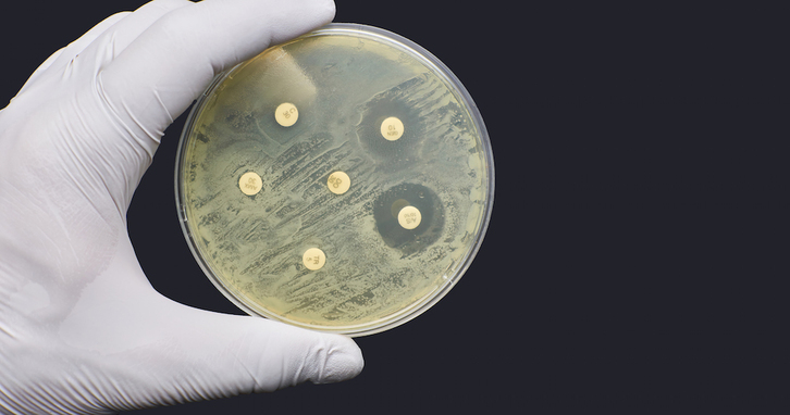Un investigador prueba con distintos antibióticos en un cultivo bacteriano.