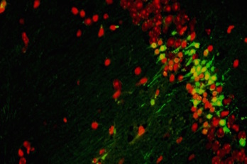 Imagen microscópica de neuronas. 