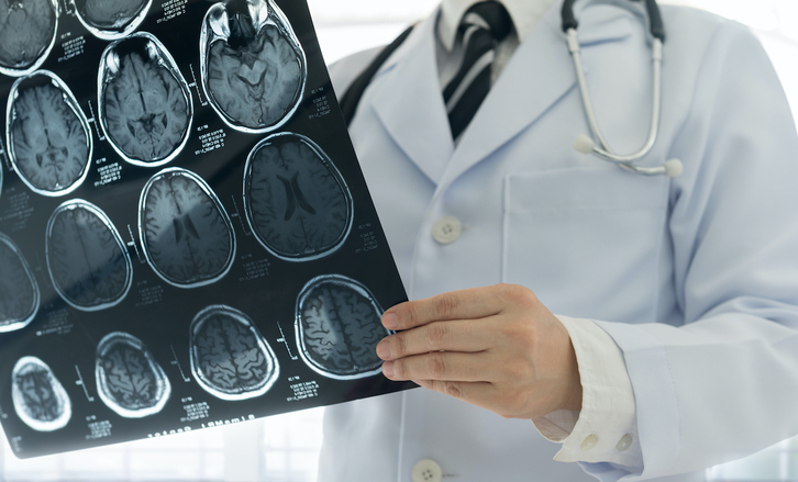 Un médico analiza un escáner del cerebro.