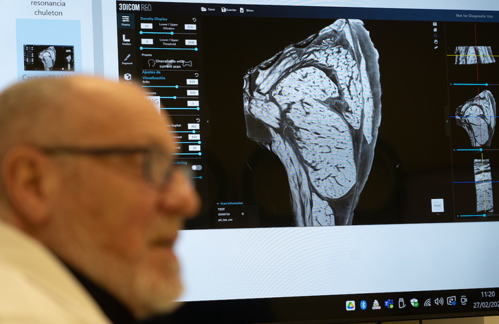 Tomografía axial de un chuletón para convertirlo en datos y con ellos, poder elaborar más con una impresora 3D. 