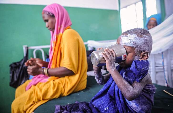 Un niño somalí bebe agua mientras espera atención médica.