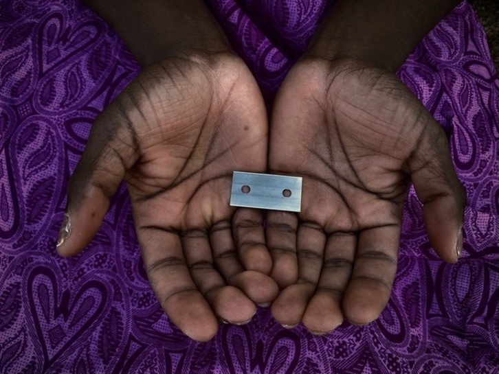 Emakumeen genitalen mutilazioa praktikatzen den 28 herrialdetatik bostetan legala da oraindik. 