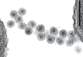 Bacteriófagos icosaedros infectando dos bacterias.