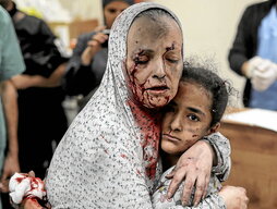 Una mujer protege a una niña, ambas heridas en un bombardeo contra la localidad de Jan Yunis.