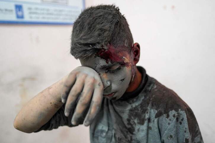 Un chico herido en un ataque en Deir al-Balah, en el hospital Al Aqsa.