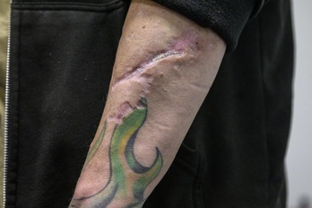 Martin, adicto a los opioides de 45 años, muestra las cicatrices de su brazo en el centro St. Ann's Corner of Harm Reduction, en el barrio neoyorquino del Bronx, el 25 de mayo de 2023.