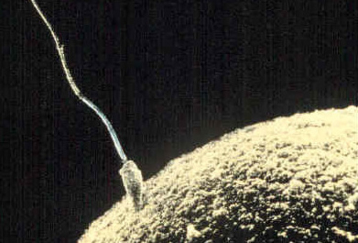 Imagen de microscopio de un espermatozoide fertilizando un óvulo.