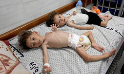 Los niños Uday y Mohammed Mahra, tratados por malnutrición en el hospital Kamal Adwan, en Beit Lahia.