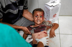 Un niño herido es tratado en el suelo del hospital Nasser, en Jan Yunis.
