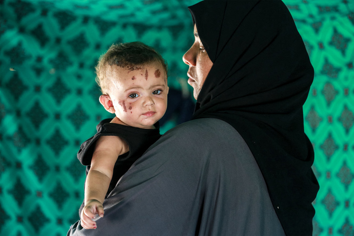 Rim Abu Hayya, la niña de tres meses herida en un bombardeo israelí que mató al resto su familia en Jan Yunis.