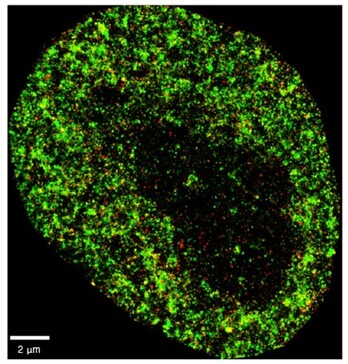 Imagen de altísima resolución de una célula cancerosa HeLa. La imagen utiliza dos colores para mostrar componentes nucleares que permiten ver estructuras detalladas dentro del núcleo celular con una resolución nanométrica.